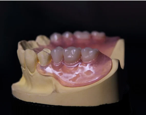 Vertex Thermosens TTRV